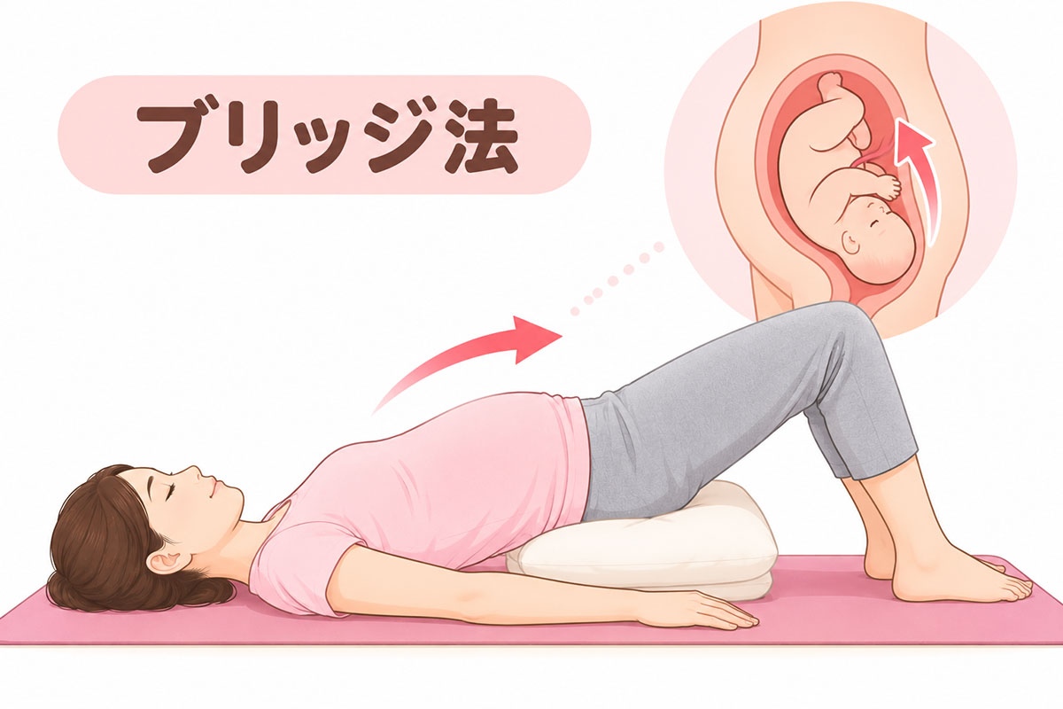 逆子体操・ブリッジ法